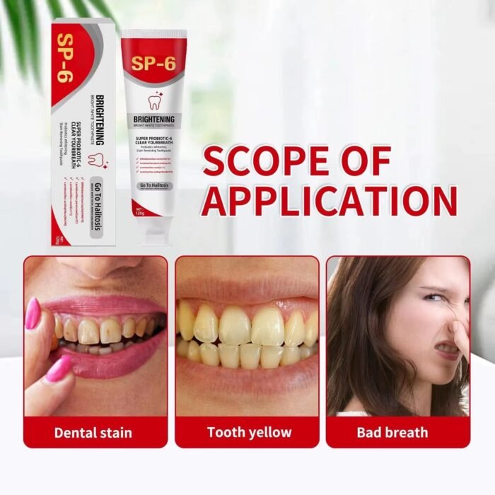 SP6 – Blanchiment Dentaire – Image 3