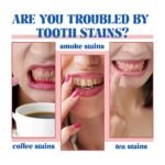 SP6 – Blanchiment Dentaire – Image 8