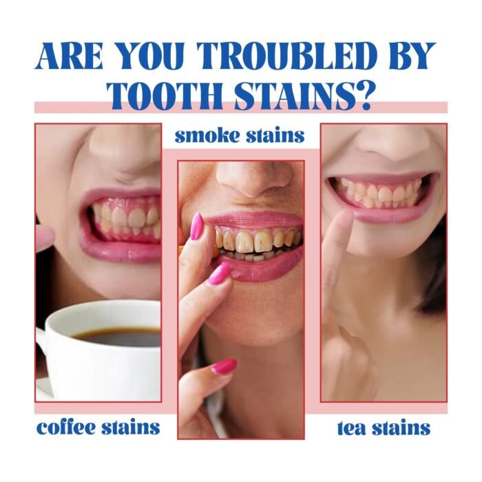 SP6 – Blanchiment Dentaire – Image 8