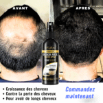 Black Rice Boost capillaire – Image 3