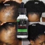 Beard Boost Elixir – Image 4